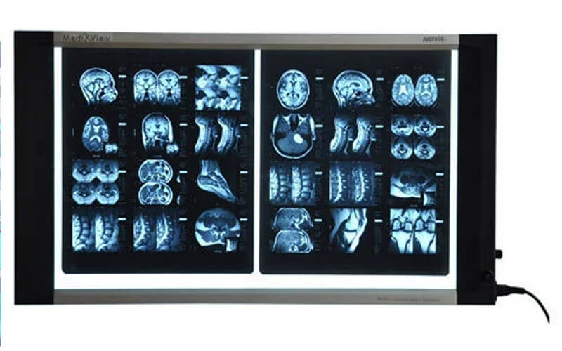X-Ray View Box